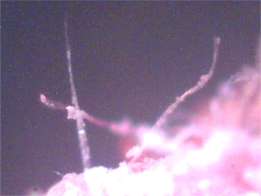 Hair like objects emerging from lesion on child's lip at 200x