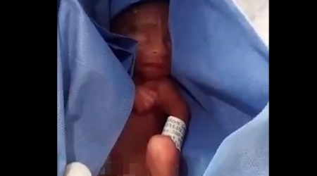 Five Month Old Baby Survived Abortion, Then Had Her Organs Harvested