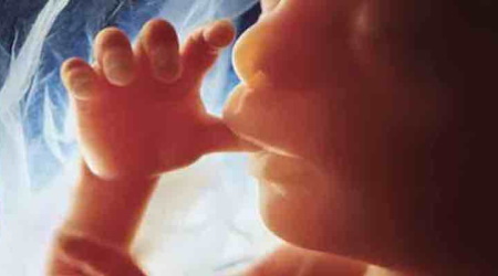 How Can America Be A Civilized Nation And Allow Dismembering Babies?